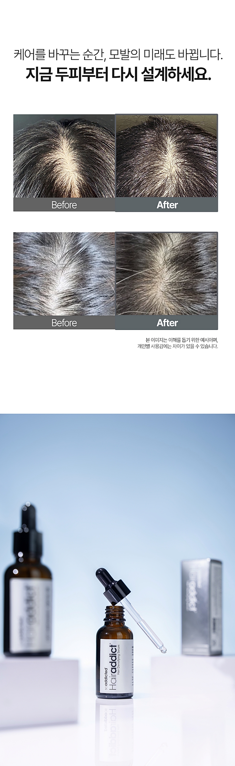 비포에프터 이미지 + 리뷰